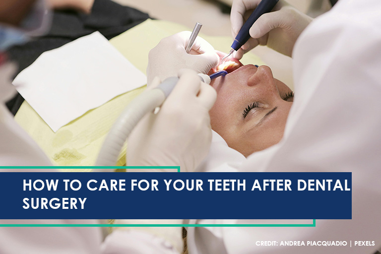 How to Care for Your Teeth After Dental Surgery