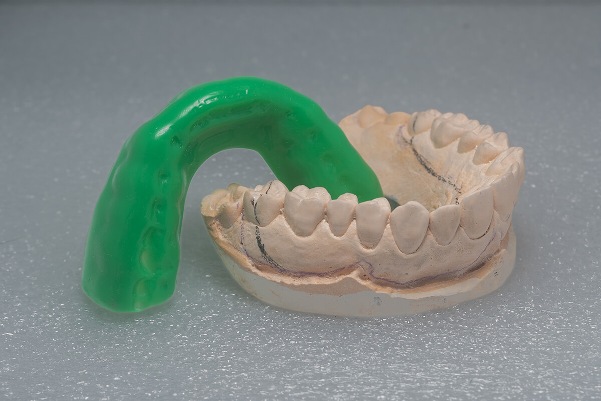 Mouth guards ease TMJ pain and improve sleep by aligning the jaw and reducing grinding